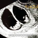 赤ちゃんの成長とエコー写真（妊娠初期）